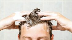 Washing After Hair Transplant